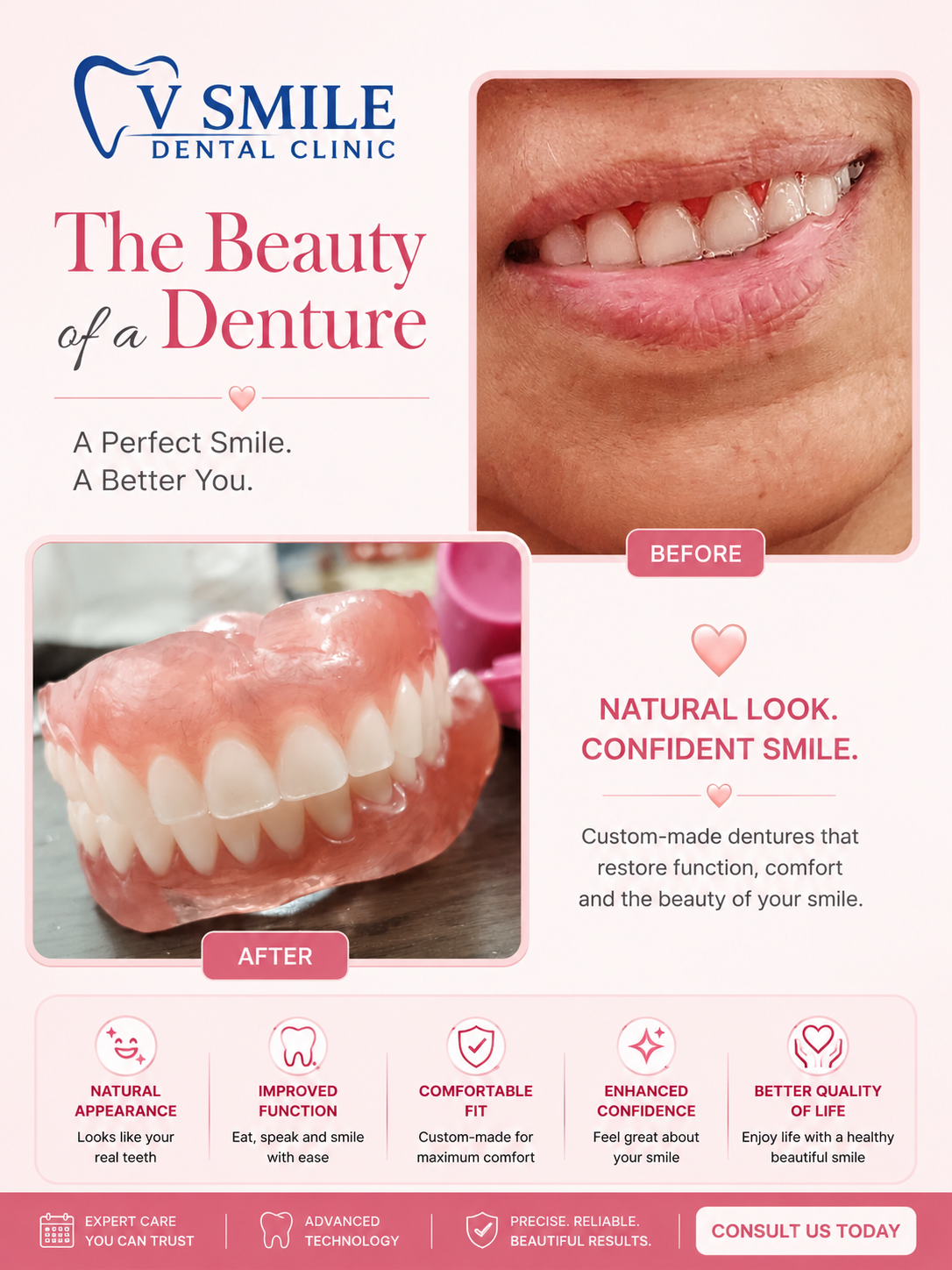 Custom denture before and after
