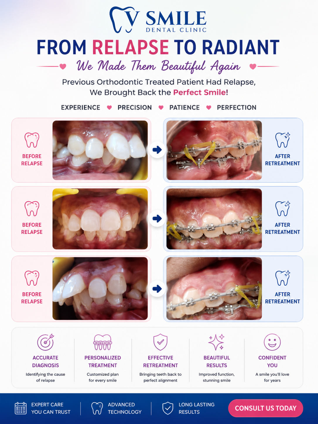 Orthodontic retreatment after relapse, before and after