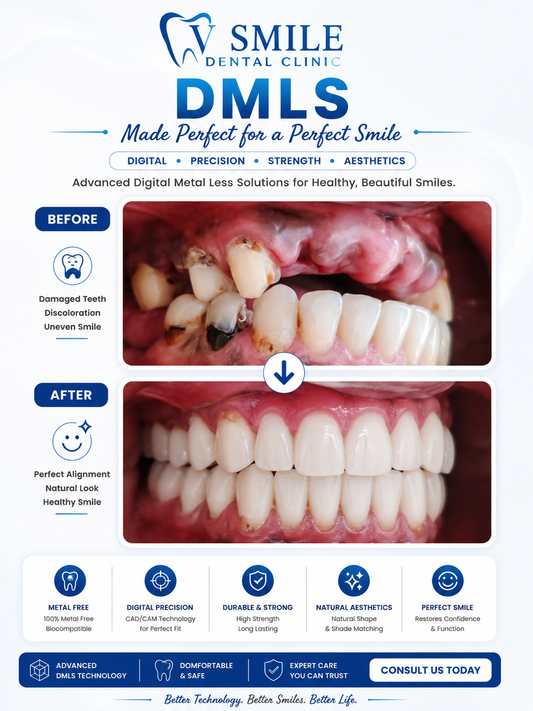 DMLS metal-free crown restoration before and after